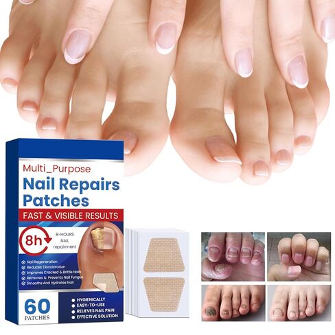 Fungal Nail Patches,60 pcs Toe Nail Fungus Treatments Patches,Nail Fungus Treatment Extra Strength,8-Hour Overnight Nail Treatment Restores Healthy Appearance in Saudi Arabia