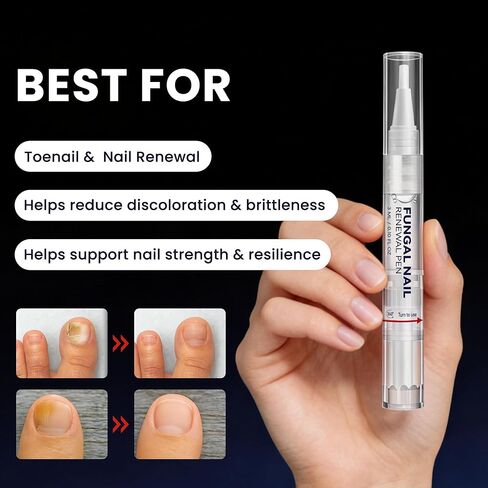 علاج فطريات أظافر القدم بقوة إضافية، قلم فطريات أظافر القدم لفطريات الأظافر وفطريات القدم مع 25% حمض غير ديسيلينيك و1% تولنافتات لتحسين الأظافر السميكة الصفراء والمتغيرة اللون والتالفة in Kuwait