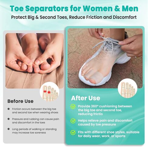 Pnrskter Big Toe Protector Caps – Gel Toe Sleeves (6 Big + 10 Medium) – Toe Covers & Cushions for Blisters, Corns, Ingrown Nails & Daily Friction (Women & Men) in Kuwait