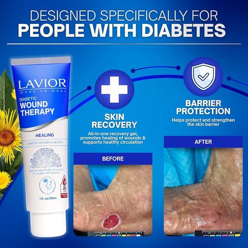 LAVIOR Diabetic Wound Gel 1oz – Natural Botanical Hydrogel for Cuts, Scrapes, Ulcers, CGM Site & Deep Wounds – Fast Healing – Inula Viscosa – ADA Endorsed, Podiatrist Tested, Vegan, Made in USA in Saudi Arabia