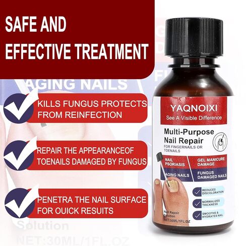 Toenail Fungus Treatment - Fast Acting For Thick, Discolored, Broken & Damaged Toe & Finger Nail, Treats Damaged Nails and Ingrown Toenails - 30ml/1oz (1pcs) in Saudi Arabia