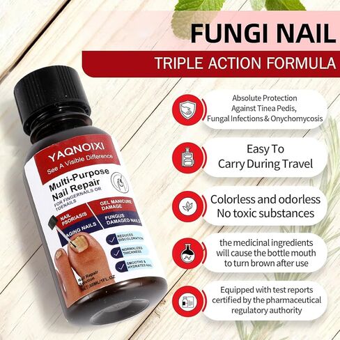 Toenail Fungus Treatment - Fast Acting For Thick, Discolored, Broken & Damaged Toe & Finger Nail, Treats Damaged Nails and Ingrown Toenails - 30ml/1oz (1pcs) in Saudi Arabia