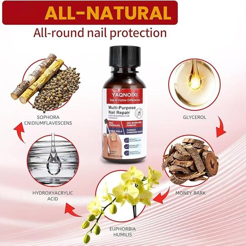 Toenail Fungus Treatment - Fast Acting For Thick, Discolored, Broken & Damaged Toe & Finger Nail, Treats Damaged Nails and Ingrown Toenails - 30ml/1oz (1pcs) in Saudi Arabia