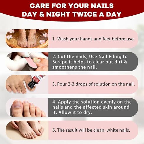 Toenail Fungus Treatment - Fast Acting For Thick, Discolored, Broken & Damaged Toe & Finger Nail, Treats Damaged Nails and Ingrown Toenails - 30ml/1oz (1pcs) in Saudi Arabia