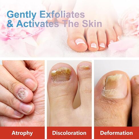 Nail Care Cream,Phrena Toenail Nail Repair for Damaged,Natural Formula with Tea Tree Oil, Oregano Oil,Vitamin E & Allantoin,60ml/2.03fl.oz in Saudi Arabia