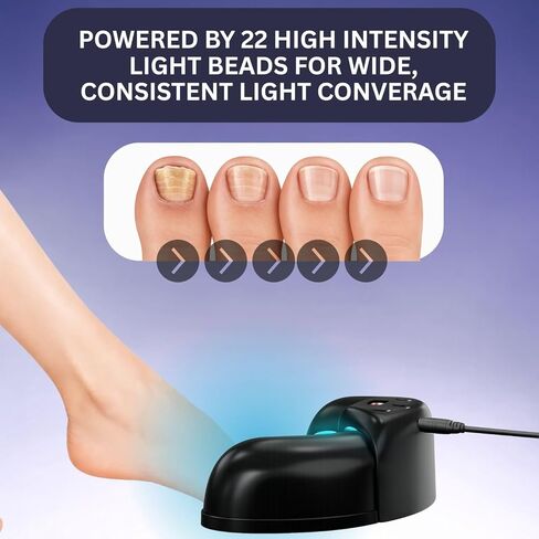 جهاز علاج فطريات الأظافر بالضوء الأزرق والأشعة تحت الحمراء لأظافر القدمين والأظافر، 470 نانومتر + 910 نانومتر ثنائي الضوء للاستخدام المنزلي جهاز علاج فطريات أظافر القدم لعلاج فطار الأظافر in Kuwait