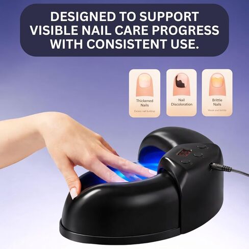 جهاز علاج فطريات الأظافر بالضوء الأزرق والأشعة تحت الحمراء لأظافر القدمين والأظافر، 470 نانومتر + 910 نانومتر ثنائي الضوء للاستخدام المنزلي جهاز علاج فطريات أظافر القدم لعلاج فطار الأظافر in Kuwait