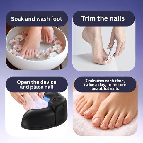 جهاز علاج فطريات الأظافر بالضوء الأزرق والأشعة تحت الحمراء لأظافر القدمين والأظافر، 470 نانومتر + 910 نانومتر ثنائي الضوء للاستخدام المنزلي جهاز علاج فطريات أظافر القدم لعلاج فطار الأظافر in Kuwait