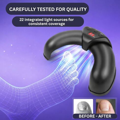 جهاز علاج فطريات الأظافر بالضوء الأزرق والأشعة تحت الحمراء لأظافر القدمين والأظافر، 470 نانومتر + 910 نانومتر ثنائي الضوء للاستخدام المنزلي جهاز علاج فطريات أظافر القدم لعلاج فطار الأظافر in Kuwait