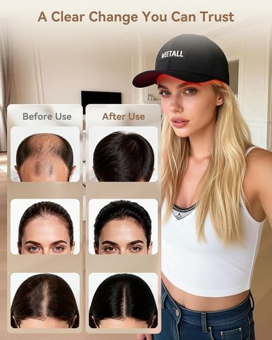 قبعة لاسلكية بإضاءة حمراء، قبعة شعر لاسلكية بإضاءة حمراء مع بطارية قابلة لإعادة الشحن بقدرة 2000 مللي أمبير في الساعة، مؤقت ذكي وجهاز تحكم، هدايا للرجال والنساء (أسود غامق) in Kuwait