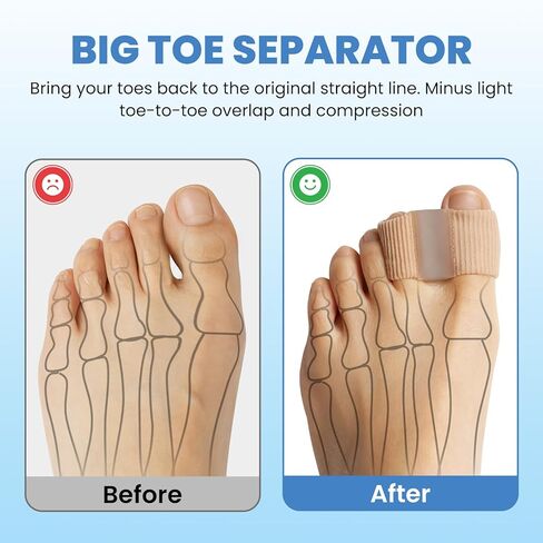 Bunion Toe Separators Corrector - 4Pcs Big Toe Spacers for for Women Men Big Toe - Breathable Toe Separators for with 2 Loops for Pain Relief, Overlapping Toes - One Size in Kuwait