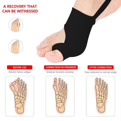 2PCS Bunion Corrector for Women & Men,Big Toe Separators-Bunion Splint-Bunion Pads-Hammer Toes Straightener-Toes Spacers Pain Relief, Comfortable & Breathable for Day/Night in Saudi Arabia