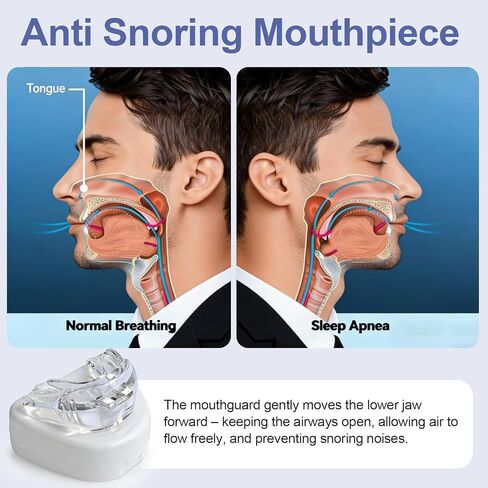 قطعة فم مضادة للشخير - واقي فم ليلي قابل للتعديل لطحن الأسنان، واقي فم للشخير للرجال والنساء -Z2 in Kuwait