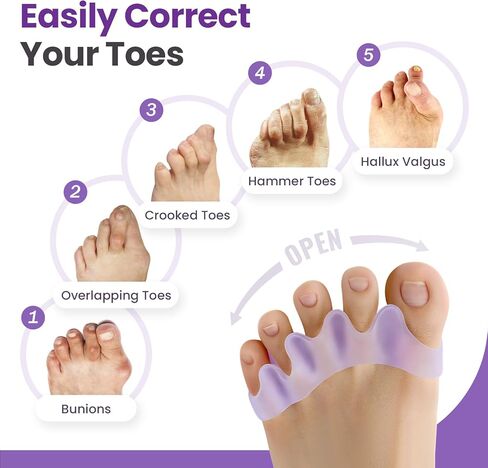 Promifun Toe Separators, 8 Pack Bunion Corrector for Women/Men, Soft Toe Spacers with Lavender Extract - Dividers to Correct Bunions, Hammertoes, Overlapping Toes (Lavender) in Saudi Arabia
