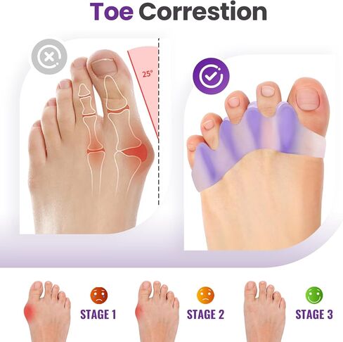 Promifun Toe Separators, 8 Pack Bunion Corrector for Women/Men, Soft Toe Spacers with Lavender Extract - Dividers to Correct Bunions, Hammertoes, Overlapping Toes (Lavender) in Saudi Arabia