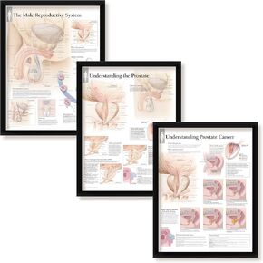 مجموعة من 3 ملصقات طبية مؤطرة الجهاز التناسلي للذكور فهم البروستاتا وفهم سرطان البروستاتا 22 بوصة × 28 بوصة مخططات جدارية in Kuwait