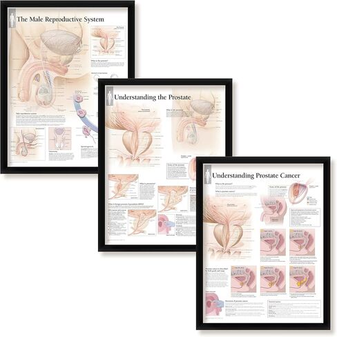 مجموعة من 3 ملصقات طبية مؤطرة الجهاز التناسلي للذكور فهم البروستاتا وفهم سرطان البروستاتا 22 بوصة × 28 بوصة مخططات جدارية in Kuwait
