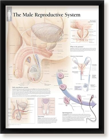 مجموعة من 3 ملصقات طبية مؤطرة الجهاز التناسلي للذكور فهم البروستاتا وفهم سرطان البروستاتا 22 بوصة × 28 بوصة مخططات جدارية in Kuwait