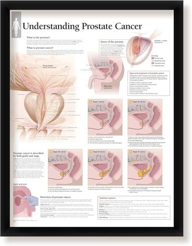 مجموعة من 3 ملصقات طبية مؤطرة الجهاز التناسلي للذكور فهم البروستاتا وفهم سرطان البروستاتا 22 بوصة × 28 بوصة مخططات جدارية in Kuwait