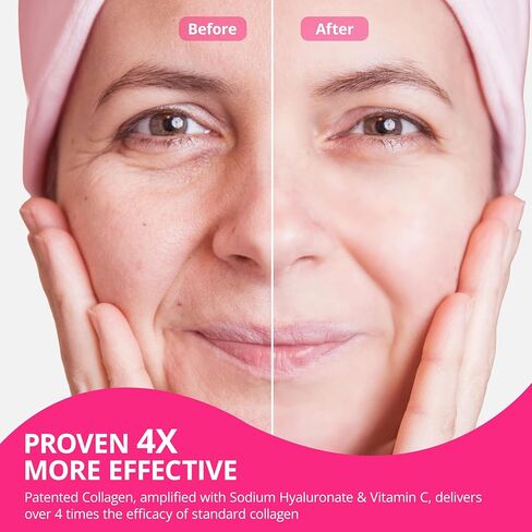 Collagen Powder for Women, Collagen Peptides Powder with Probiotics, Prebiotic Collagen Protein for Skin, Hair, Bone & Joint | 16-in-1 Sugar-Free Formula, Unflavored in Saudi Arabia