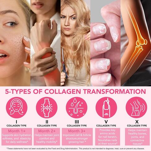 Multi Collagen Peptides Powder, 1 lb Unflavored Hydrolyzed Collagen Types I, II, III, V, X，16 oz (41 Servings)-Hyaluronic Acid Power,Grass Fed Collagen Supplements for Women and Men, Non GMO in Saudi Arabia