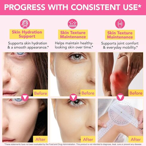 Multi Collagen Peptides Powder, 1 lb Unflavored Hydrolyzed Collagen Types I, II, III, V, X，16 oz (41 Servings)-Hyaluronic Acid Power,Grass Fed Collagen Supplements for Women and Men, Non GMO in Saudi Arabia