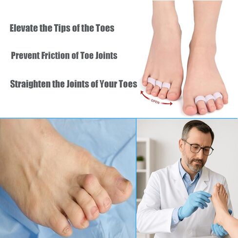 Hammer Toe Straightener Toe Corrector for Women, 8Pcs Toe Support Pads Cushion, Triple Loop Gel Toe Spacers & Separators for Overlapping, Curled, Curved, Claw Toe (White) in Kuwait