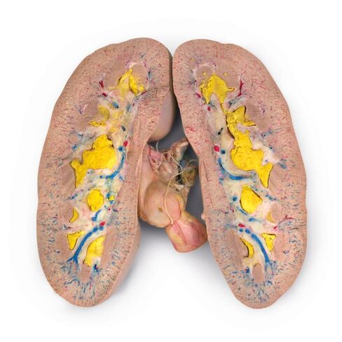 Carolina's Perfect Solution® Pig Kidney, Triple Injection, Pail in Kuwait