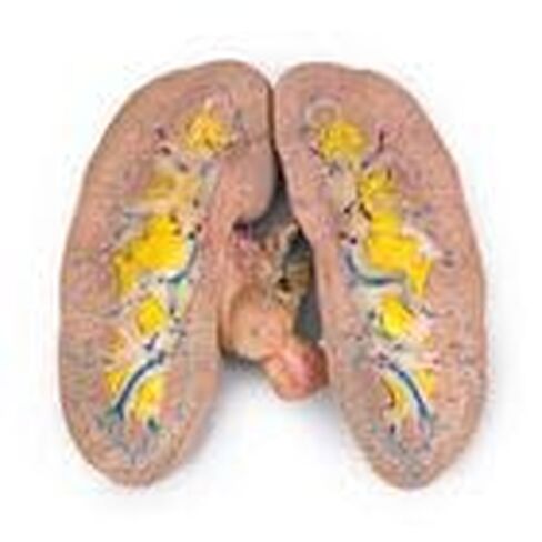 Carolina's Perfect Solution® Pig Kidney, Triple Injection, Pail in Kuwait