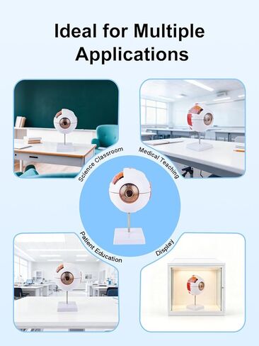 6X Enlarged Eyeball Model Detachable Eye Anatomy Model with Stand for Medical Science Education & Classroom Display in Kuwait