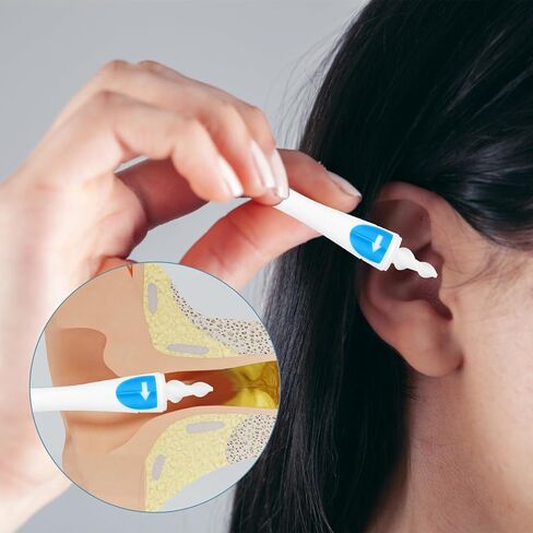 Prasacco 19 Pieces Ear Wax Removal Tool, 3 in 1 Q-Grips Ear Wax Remover with 16 Replacement Reusable Soft Silicone Tips for Cleaner Earwax Ear Wax Removal Kit Ear Cleaner for Adults and Kids in Saudi Arabia
