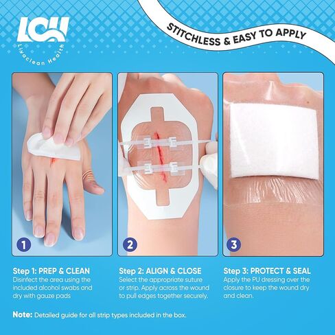 طقم شرائط إغلاق الجروح مكون من 43 قطعة - ضمادات الفراشة، نوعان من ضمادات الخياطة ذات السحاب، وسادات الشاش، ضمادات البولي يوريثان، مسحات الكحول والقطن - طقم إغلاق الجروح في حالات الطوارئ للجروح والتمزقات والسحجات in Kuwait