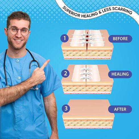 طقم شرائط إغلاق الجروح مكون من 43 قطعة - ضمادات الفراشة، نوعان من ضمادات الخياطة ذات السحاب، وسادات الشاش، ضمادات البولي يوريثان، مسحات الكحول والقطن - طقم إغلاق الجروح في حالات الطوارئ للجروح والتمزقات والسحجات in Kuwait