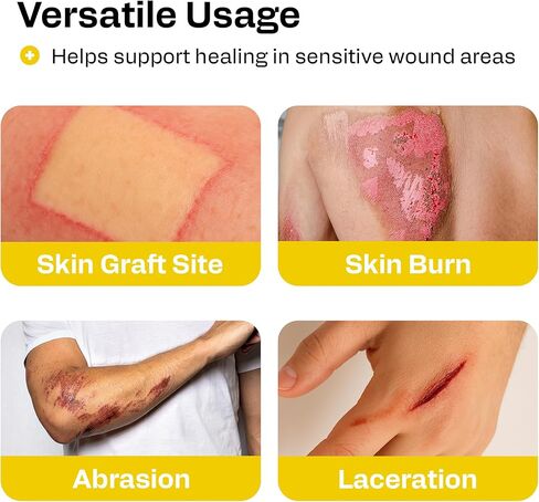 ضمادة زيروفورم بترولاتوم الطبية من AWD - وسادة شاش غير ملتصقة - رقعة شاش شبكية دقيقة معقمة - لوازم الرعاية الصحية للعناية بالجروح والحروق والتمزقات ومساعد ترقيع الجلد (صندوق من 25) (4 × 4 بوصات) in Kuwait