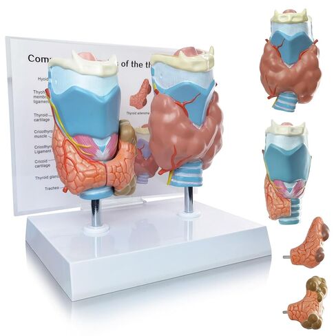 نموذج تشريحي لأمراض الغدة الدرقية البشرية العلمية من إيفوتك - 4 أجزاء بالحجم الطبيعي أداة تعليمية للدراسة الطبية مع حامل ودليل لإظهار تضخم الغدة الدرقية وسرطان الغدة الدرقية ومرض القبور in Kuwait