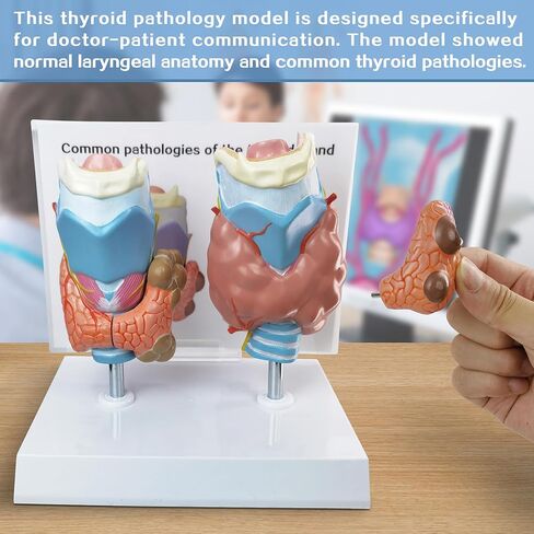 نموذج تشريحي لأمراض الغدة الدرقية البشرية العلمية من إيفوتك - 4 أجزاء بالحجم الطبيعي أداة تعليمية للدراسة الطبية مع حامل ودليل لإظهار تضخم الغدة الدرقية وسرطان الغدة الدرقية ومرض القبور in Kuwait