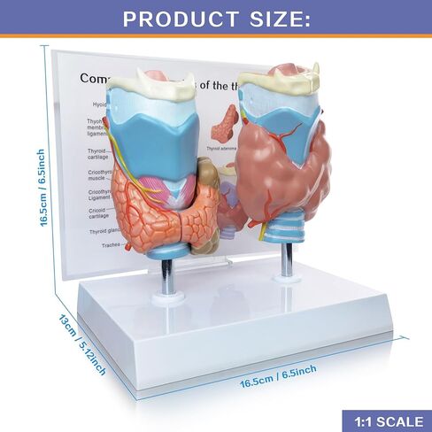 نموذج تشريحي لأمراض الغدة الدرقية البشرية العلمية من إيفوتك - 4 أجزاء بالحجم الطبيعي أداة تعليمية للدراسة الطبية مع حامل ودليل لإظهار تضخم الغدة الدرقية وسرطان الغدة الدرقية ومرض القبور in Kuwait