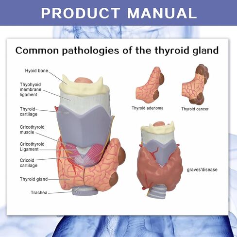 نموذج تشريحي لأمراض الغدة الدرقية البشرية العلمية من إيفوتك - 4 أجزاء بالحجم الطبيعي أداة تعليمية للدراسة الطبية مع حامل ودليل لإظهار تضخم الغدة الدرقية وسرطان الغدة الدرقية ومرض القبور in Kuwait