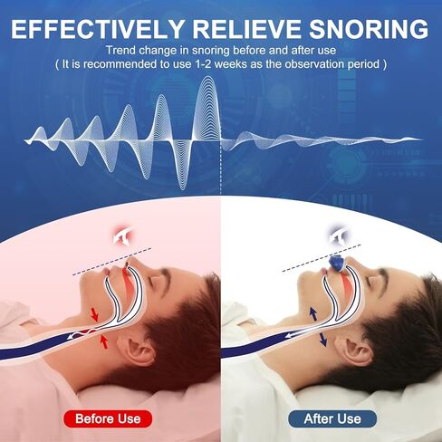 Anti Snore Device,Double Vortex Electric Double Vortex Snoring Solution,Mini Portable Stop Snoring Devices Stopper,Adjustable Wind Speed Snoring Prevention Nasal Dilators,Up to 8 Hours (Blue-2) in Kuwait