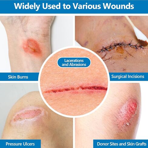 40 Pack Medical Xeroform Petrolatum Dressing Patch,4"x4"Non-Adherent Gauze Pads,Soft Fine Mesh Gauze Patch for Wound Care,Burns,Lacerations,Skin Grafts & Surgical Incisions,Individual Packaged in Kuwait