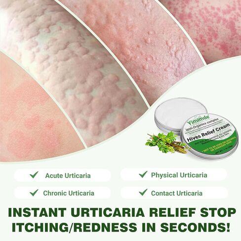 كريم تخفيف الشرى من خلايا النحل، علاج سريع المفعول للطفح الجلدي التحسسي، الأكزيما، حكة الجلد، مركب عضوي عشبي طبيعي، التحكم في الحساسية، 1 أونصة in Kuwait