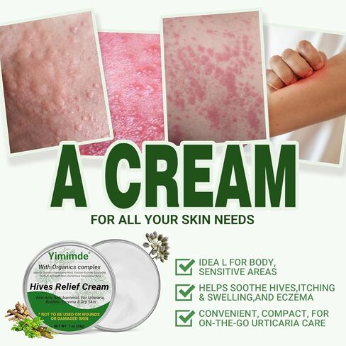 كريم تخفيف الشرى من خلايا النحل، علاج سريع المفعول للطفح الجلدي التحسسي، الأكزيما، حكة الجلد، مركب عضوي عشبي طبيعي، التحكم في الحساسية، 1 أونصة in Kuwait
