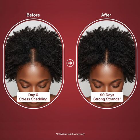 Growth Gummies for Black Women, 60 Vegan Gummies, Daily Hair Nourishment with Biotin, Collagen & Botanical Extracts, Supports Healthy Hair Growth & Strength in Saudi Arabia