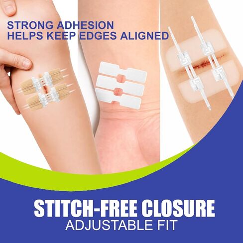 40 Pack Butterfly Bandages for Wound Closure, Wound Closure Kit, Stitchless Skin Closure Strips, Alternative to Stitches for Cuts & Lacerations with PU Film, Nonwoven & Transparent Dressing in Saudi Arabia