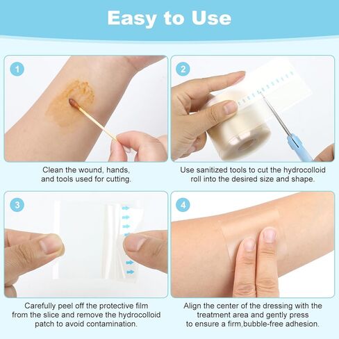 Hydrocolloid Roll Bandages, Extra Long Cut-to-Size Pimple Patch Tape for Face & Body, Ultra Absorbent Large Hydrocolloid Patch for Blister, Burn, Wound Care, Waterproof & Flexible (2in x 5.8ft) in Saudi Arabia