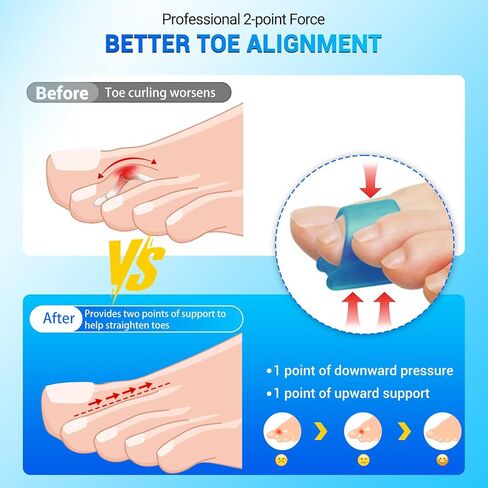 Hammer Toe Straightener - Hammer Toe Corrector for Women & Men - (6Pcs, Blue) - Gel Toe Splint Relief for Bunion, Claw, Crooked, Hammer, Broke Support - 3 Different Sizes (S/M/L) in Kuwait