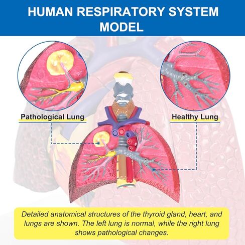 JNMFTD نموذج الجهاز التنفسي البشري، حجم الحياة الصغير 5 أجزاء صحية ومرضية الرئة مقارنة الحنجرة القلب نموذج تشريح الأعضاء القابلة للإزالة مع بطاقة يدوية PVC لعرض الدراسة الطبية التعليمية in Kuwait