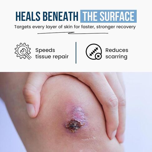 العناية بالجروح بالإضافة إلى مكمل مركب الكولاجين - ببتيدات الكولاجين متعددة المصادر (البقري، البحري، الدجاج، قشر البيض) - يدعم صحة الجلد والأنسجة - 90 كبسولة - خالية من الغلوتين، غير معدلة وراثيًا، صديقة للكيتو in Kuwait