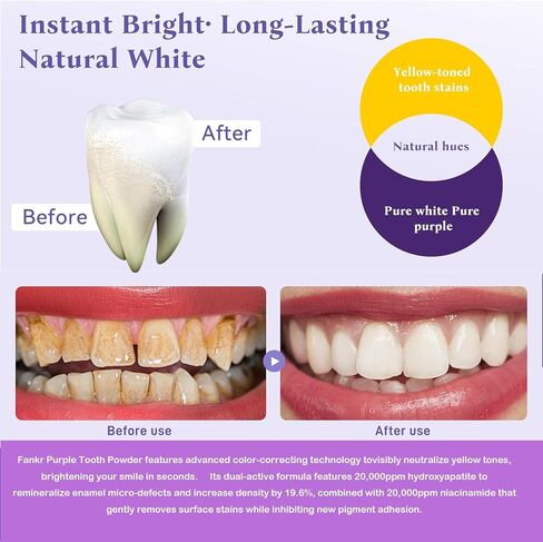 مسحوق تبييض الأسنان مع 20.000 جزء في المليون هيدروكسيباتيت و20.000 جزء في المليون نياسيناميد، مركب إعادة التمعدن R5X الحاصل على براءة اختراع، تبييض الأسنان وإزالة البقع ومعطر التنفس. in Kuwait