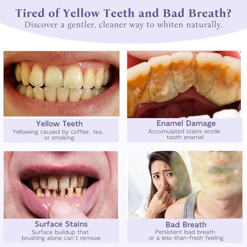 مسحوق تبييض الأسنان مع 20.000 جزء في المليون هيدروكسيباتيت و20.000 جزء في المليون نياسيناميد، مركب إعادة التمعدن R5X الحاصل على براءة اختراع، تبييض الأسنان وإزالة البقع ومعطر التنفس. in Kuwait